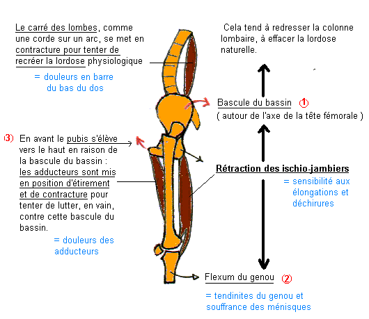 Ischio jambiers